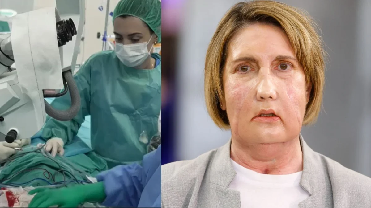 Realizan el primer trasplante de cara con una donante por eutanasia
