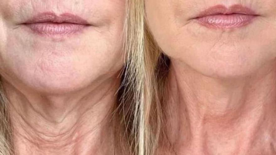 Alertan por suplemento popular que podría alimentar el cáncer