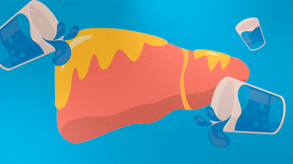 Cómo afecta el calor al hígado graso y qué medidas tomar para protegerlo