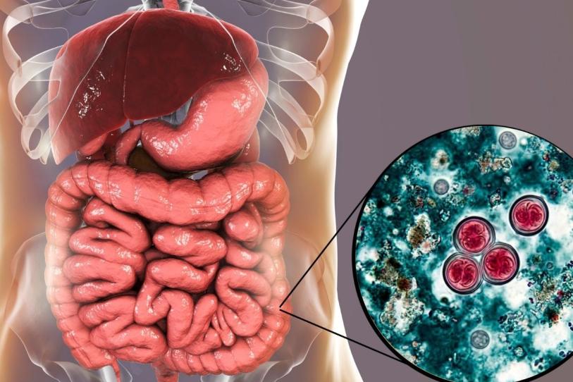 Cyclospora: qué es, síntomas además de la diarrea repentina y cómo se transmite