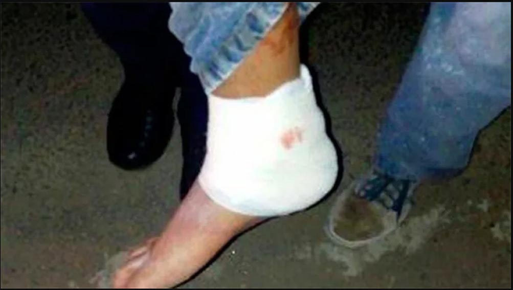 A balazos lesionaron a varón tras incidente vial en Santa Rosa