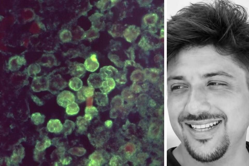 Deja ‘ameba comecerebros’ su primera víctima en Yucatán