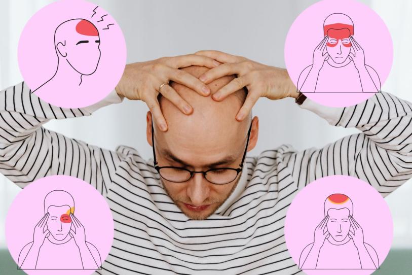 ¿Dónde te duele la cabeza? La zona puede dar pistas sobre su posible origen