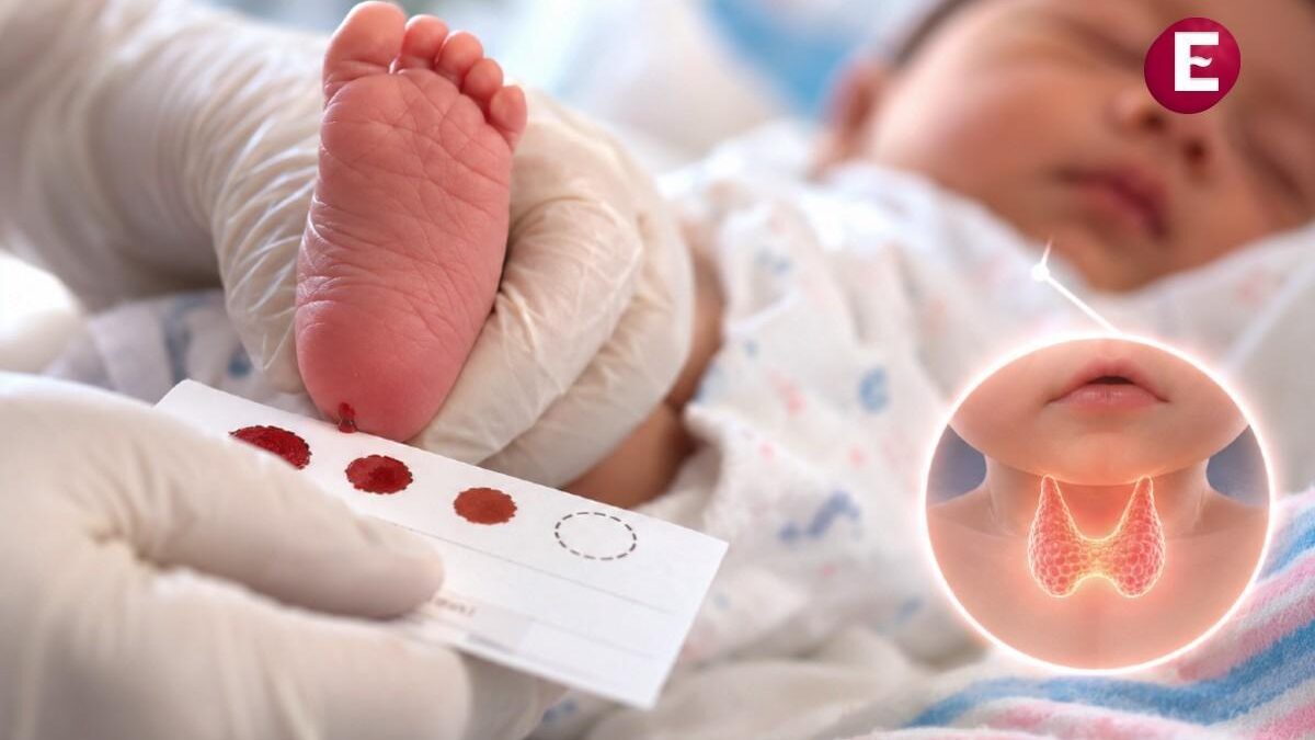 Recomiendan tamiz neonatal para detección temprana de hipotiroidismo