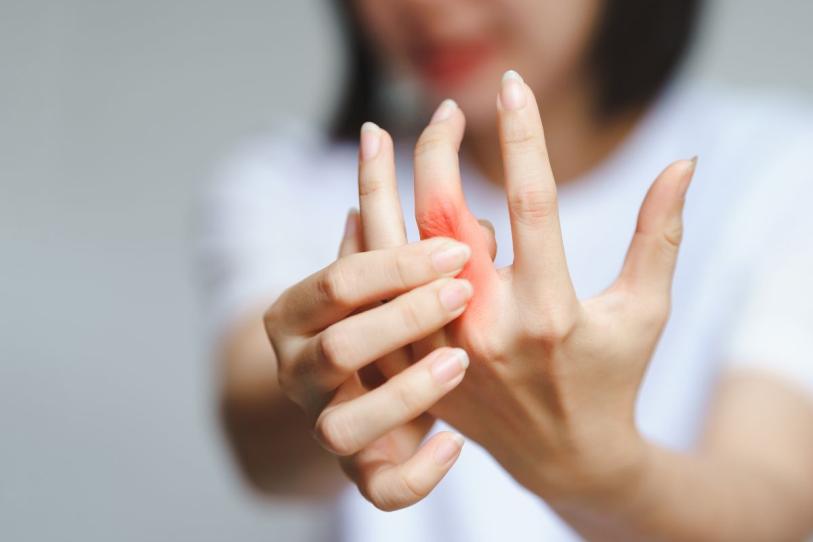 ¿Quieres cuidar tus articulaciones? Algunos riestos de artritis pueden reducirse con estos hábitos